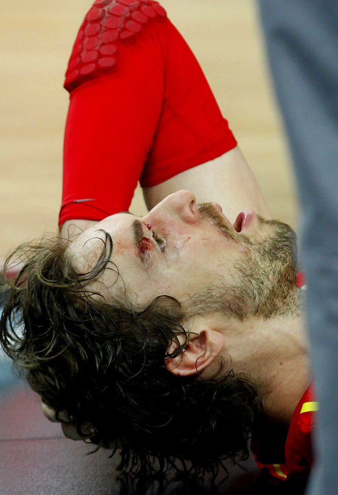 Espa�a y Estados Unidos volvieron a ofrecer uno de los mejores espect�culos nunca visto en una cancha. Pau Gasol, una de las figuras del encuentro, pag� el esfuerzo y la dureza del rival y termin� con un corte en la ceja, fruto de un golpe de LeBron.